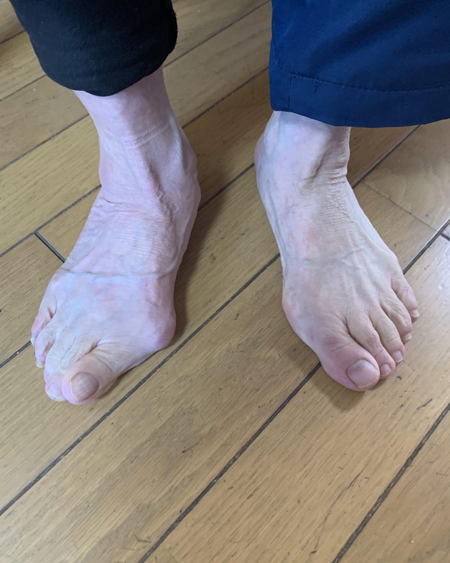 両足の写真